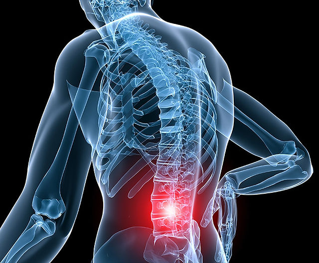 Evitarea artritei și osteoartritei cu Bonengem